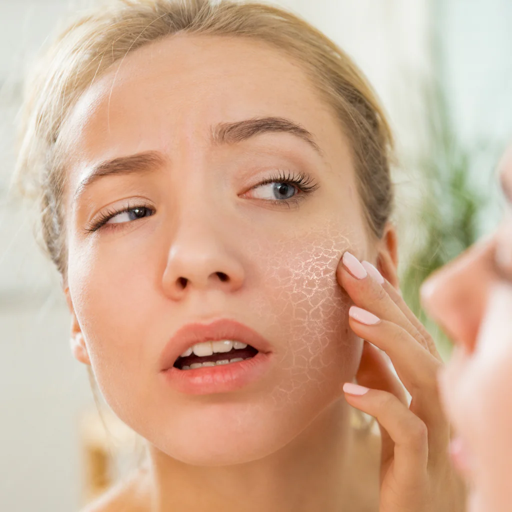 What is the Best Treatment for Dry Skin?