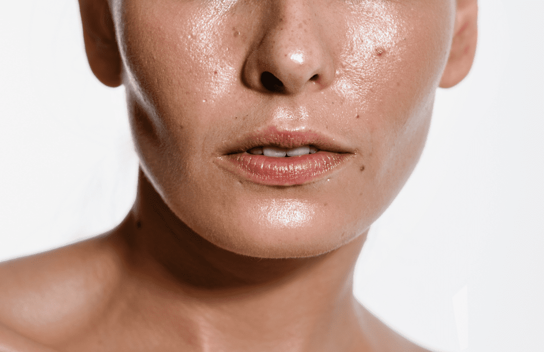 Oily Skin? Cleanse Without Stripping!