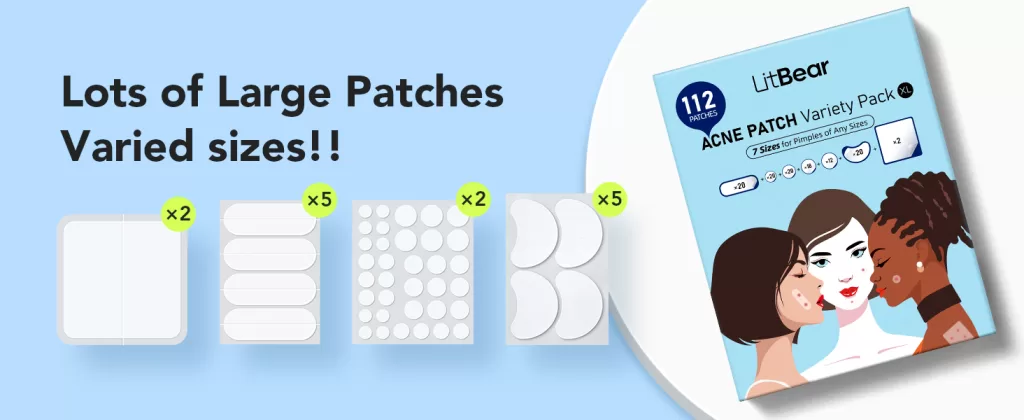 Image of acne patches Teen acne, Adult acne