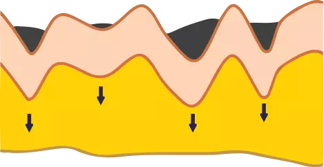 Image of The effects of topical cosmetic use of Collagen Select Anti-Aging