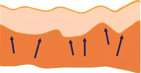 Image of The effects of using Collagen Collagen Select Anti-Aging