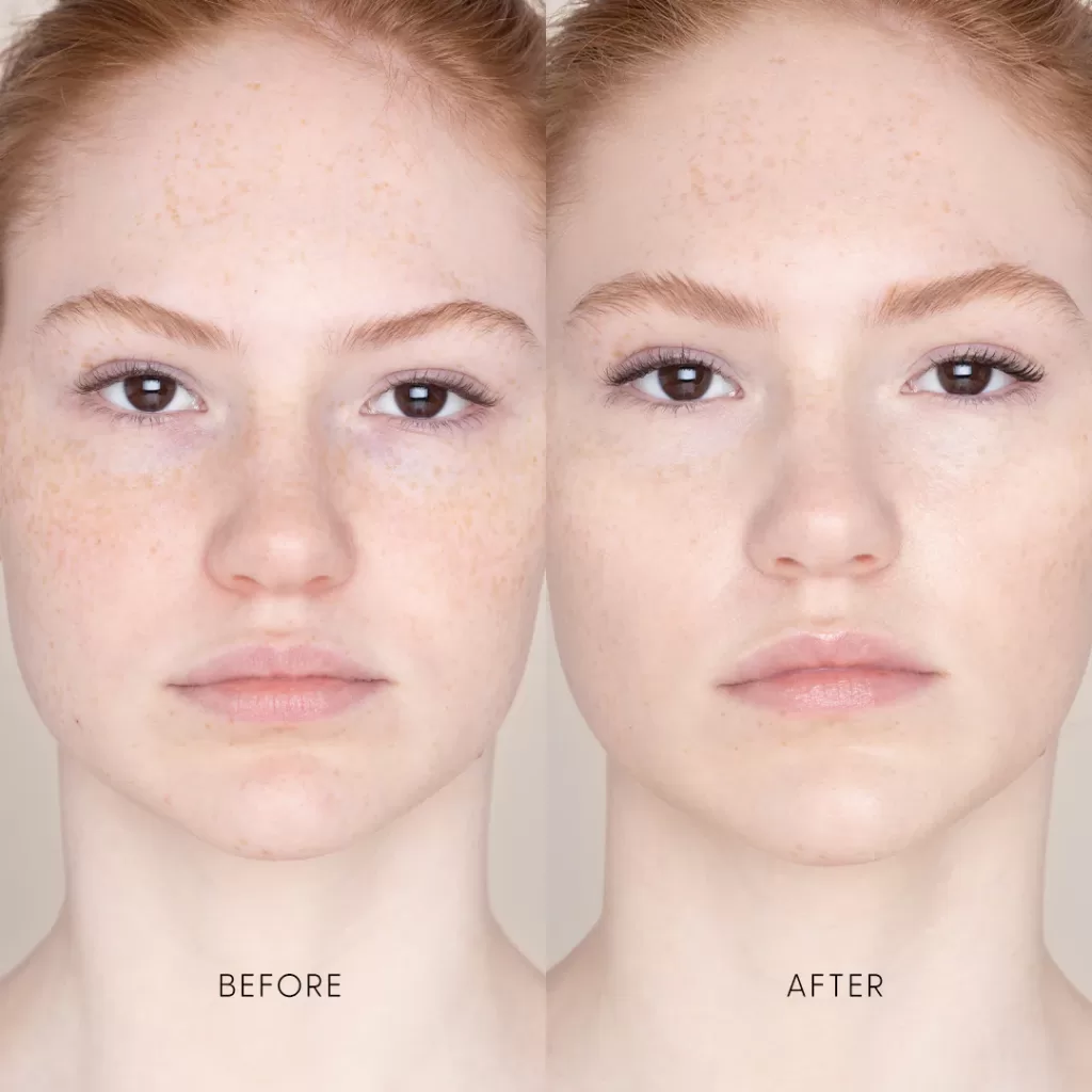 Image of a face before and after using the right products for Beautiful Crazy Skin Days