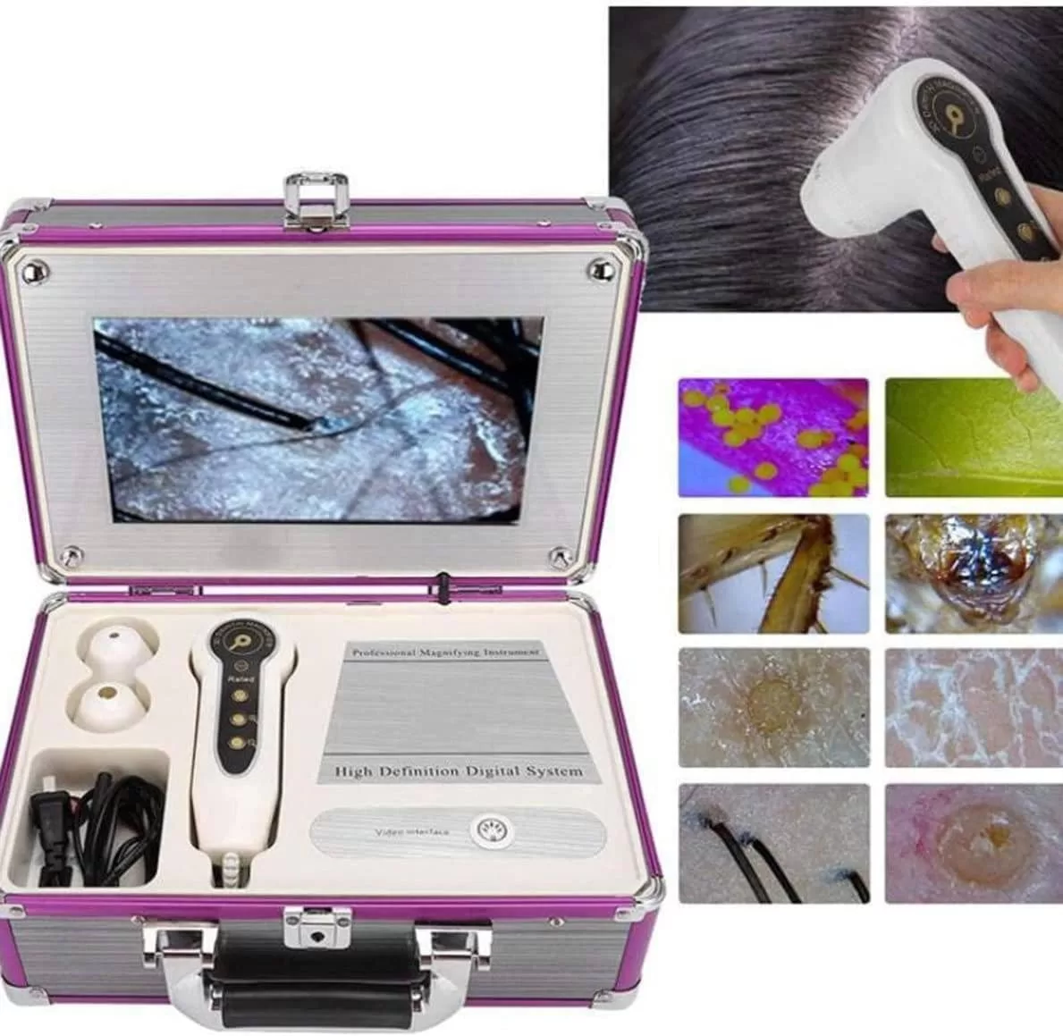 Image of DNA-Based Skin Analysis kit.