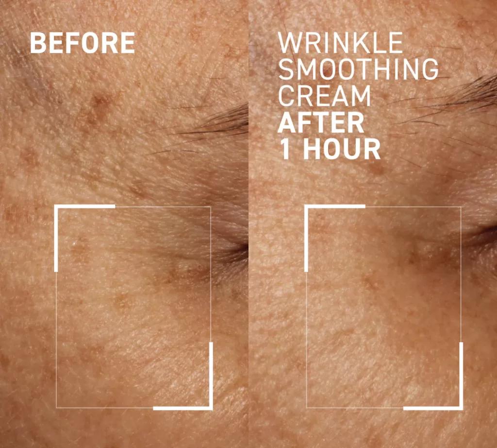 Image of Wrinkles before and after,Dr. Brandt WRINKLE SMOOTHING CREAM