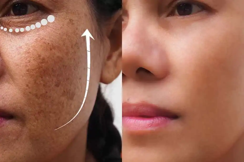 Image of a face showing the changes: Skin Whitening, Glass Skin & Slugging: Full Skincare Guide