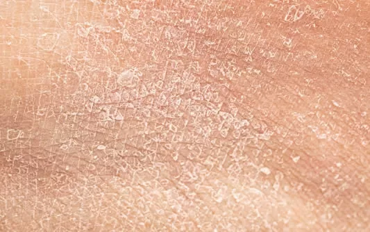 Image of Dry skin ,skincare makeup kit