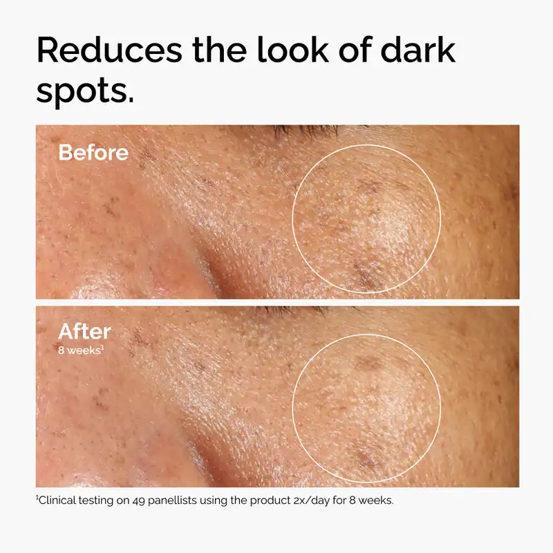 Image of a face showing before and after : Skin Whitening, Glass Skin & Slugging: Full Skincare Guide